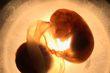 Calidad del aire de Temuco podría afectar el desarrollo fetal