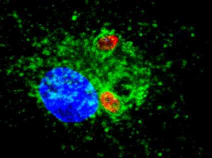 Leishmania: Conoce la investigación del nuevo profesor de TM